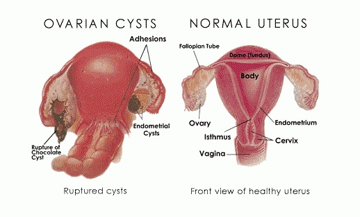 Unexplained Bleeding